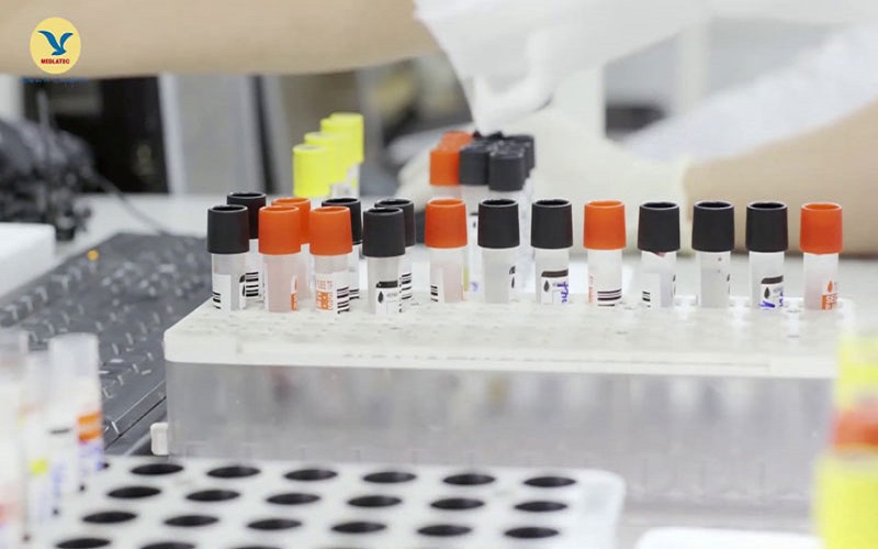 Xét nghiệm máu tìm kháng thể xác định bạch cầu đơn nhân